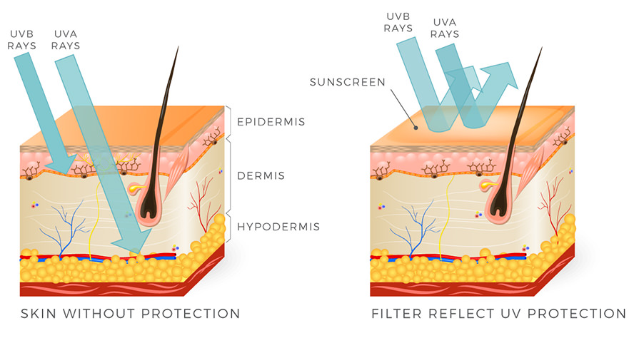 UV radiation and skin cancer