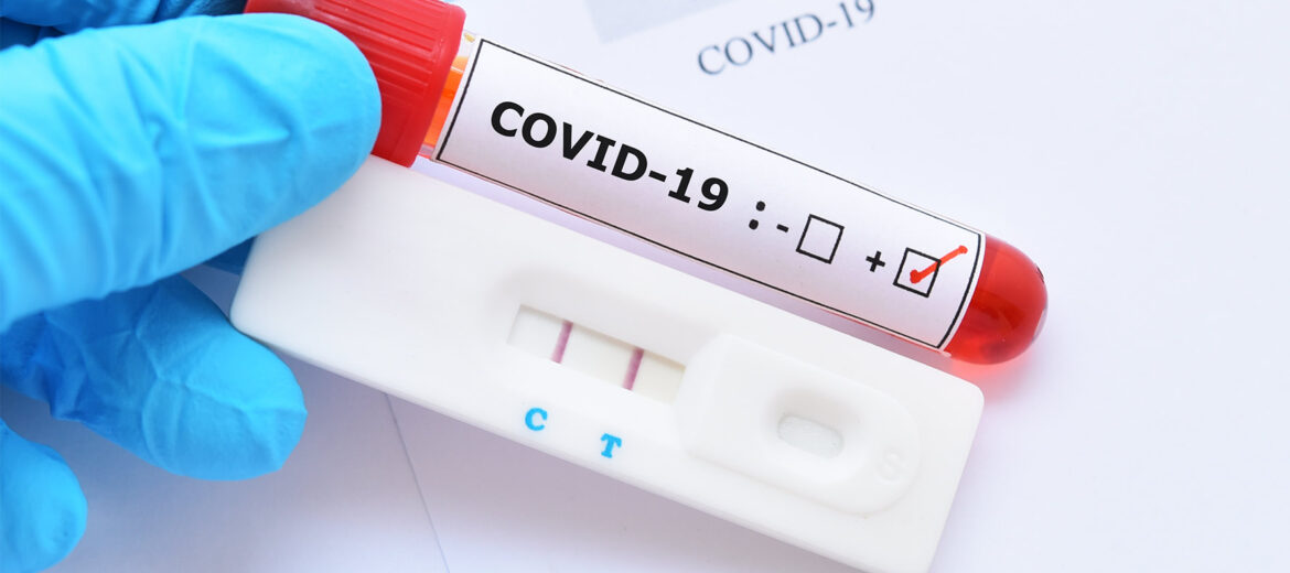 COVID-19 Antibody Testing