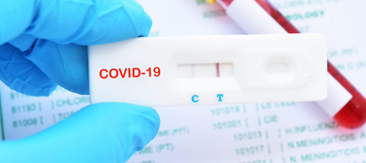 COVID-19 Rapid Tests